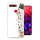 Funda Honor View 20 Gel Dibujo Gatitos