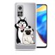 Funda Xiaomi MI 10T y M10T Pro TPU Peritos