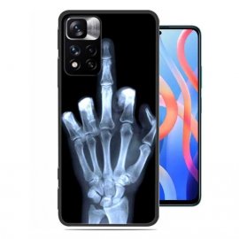 Funda Redmi Note 11 Pro TPU Dedo