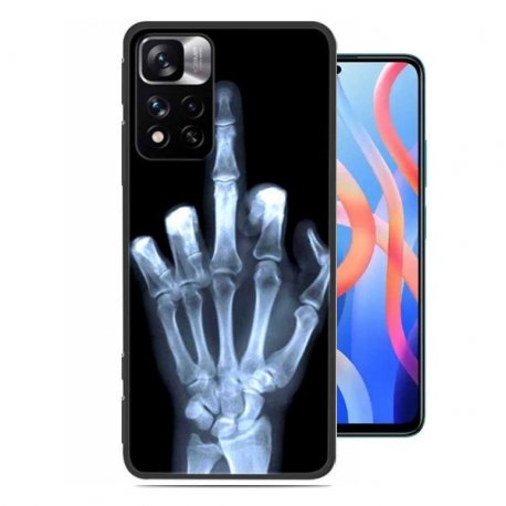 Funda Redmi Note 11 Pro TPU Dedo