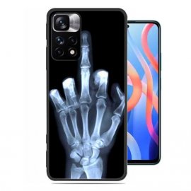 Funda silicona Redmi Note 11y 11S Dedo