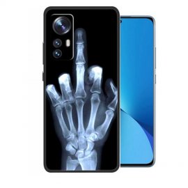 Funda silicona Xiaomi 12 Manita