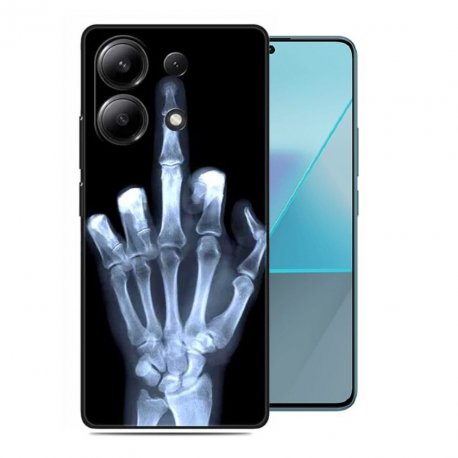 Funda silicona Xiaomi Redmi Note 13 4G o 5G Rayo X