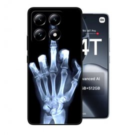 Funda silicona Xiaomi 14T Rayos X