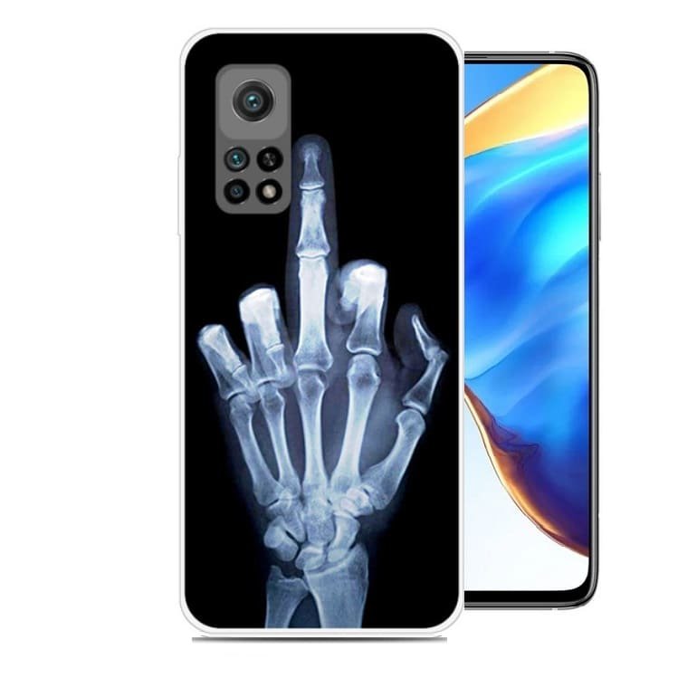 Funda Xiaomi MI 10T y M10T Pro TPU Mano