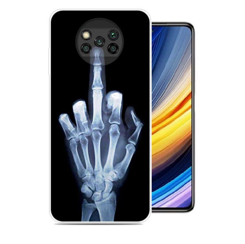 Funda Silicona transparente Pocophone Poco X3 Pro dedo
