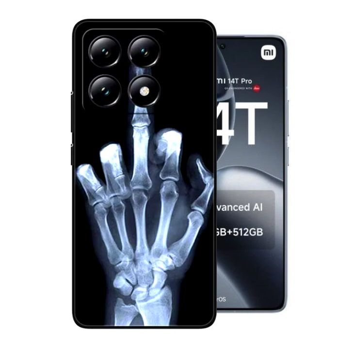 Funda silicona Xiaomi 14T Rayos X